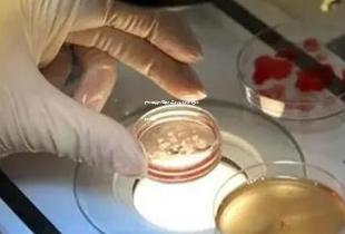 广州地贫试管婴儿三代多少钱?性价比如何! 广州地贫试管婴儿三代多少钱?性价比如何!