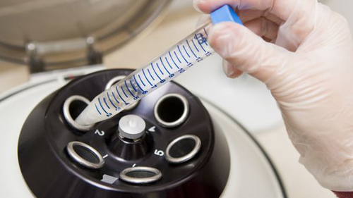 移鲜胚好还是囊胚好