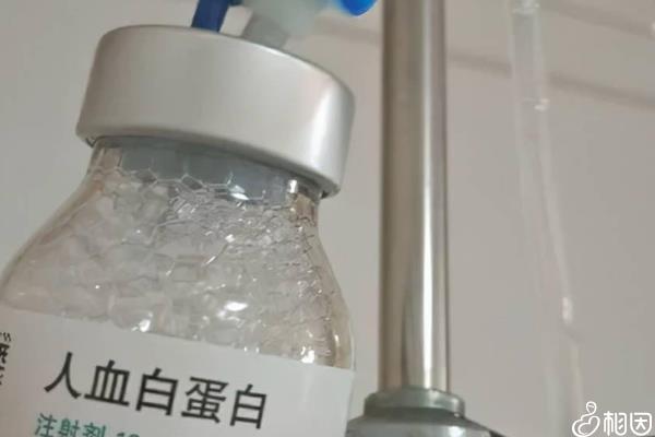 轻度腹水白蛋白注射量