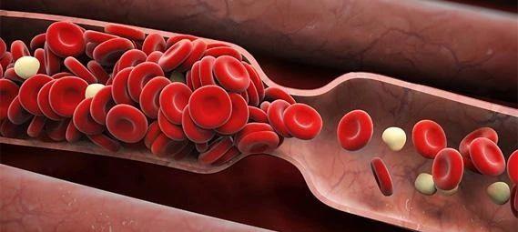 什么是抗磷脂综合征