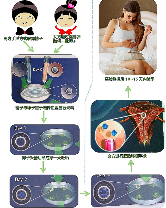 第一代试管婴儿流程