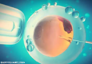 做试管夫妻双方要同时做检查吗？夫妻双方做试管婴儿需要检查哪些？