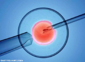 湛江试管婴儿公立医院是哪一家？附详情费用！