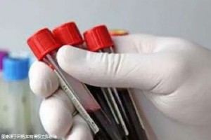 柳州准备去做试管婴儿步骤有哪些，该如何收费！