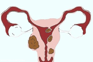 西安试管需要费用，附带费用参考！