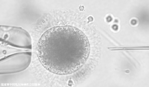 百色做三代试管婴儿做一次大约多少钱？