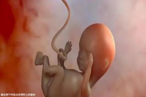 做第三代试管出生的孩子会更加聪明健康吗！费用也会有区别！