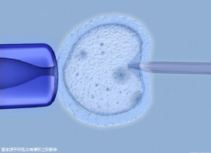 重医附一院可以做试管婴儿吗，能补多少钱！