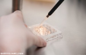 高龄在合肥做三代试管需要多少钱，需要带多少钱！