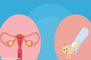 高龄女性可以去泰国做试管吗，补贴政策解读！