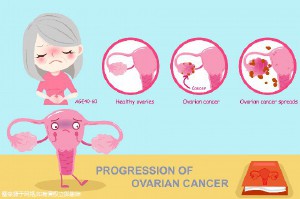 菏泽做第三代试管大概多少钱,管要花多少!