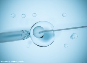 枣庄试管婴儿价格明细表公布？附价格影响因素！
