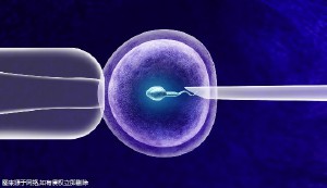 泉州哪里可以做三代试管婴儿!贵多少钱!